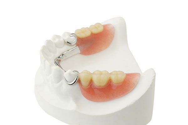 Выбор подходящего протеза осуществляет стоматолог