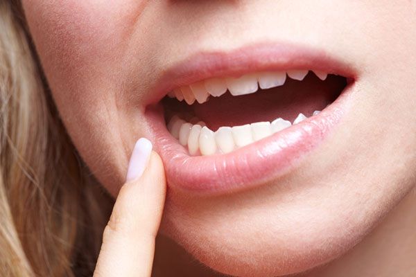 Зубы становятся чувствительными к приему пищи и напитков